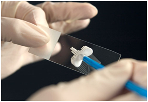 Pap-Test auf Infektion humanes papillomavirus